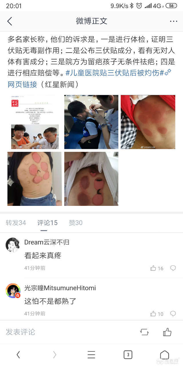 点击放大