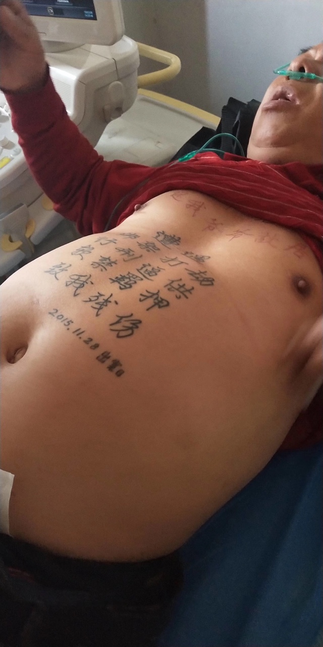 点击放大
