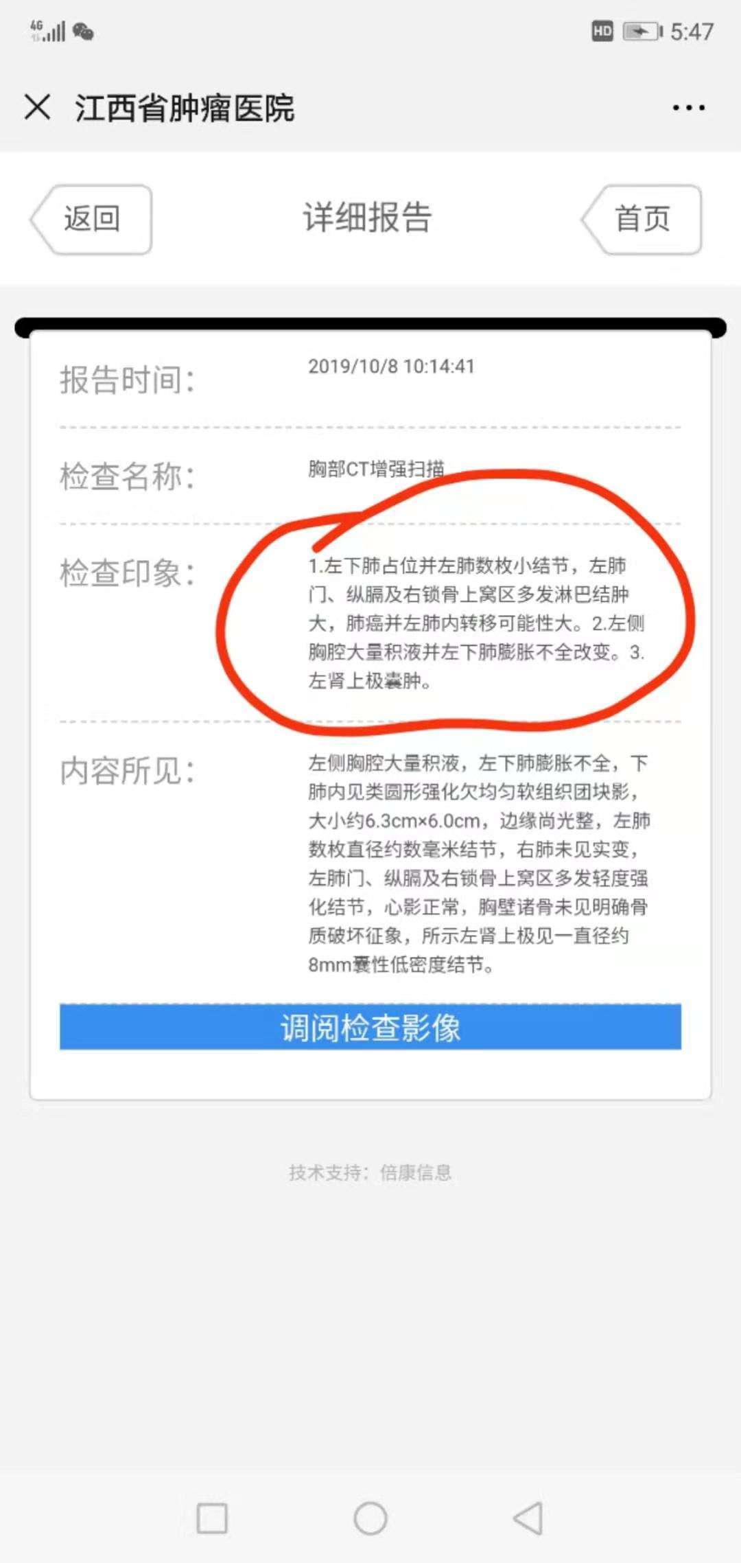 点击放大